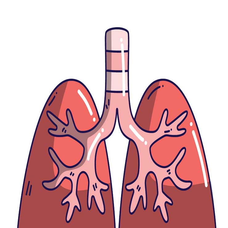 Pulmonary-embolism