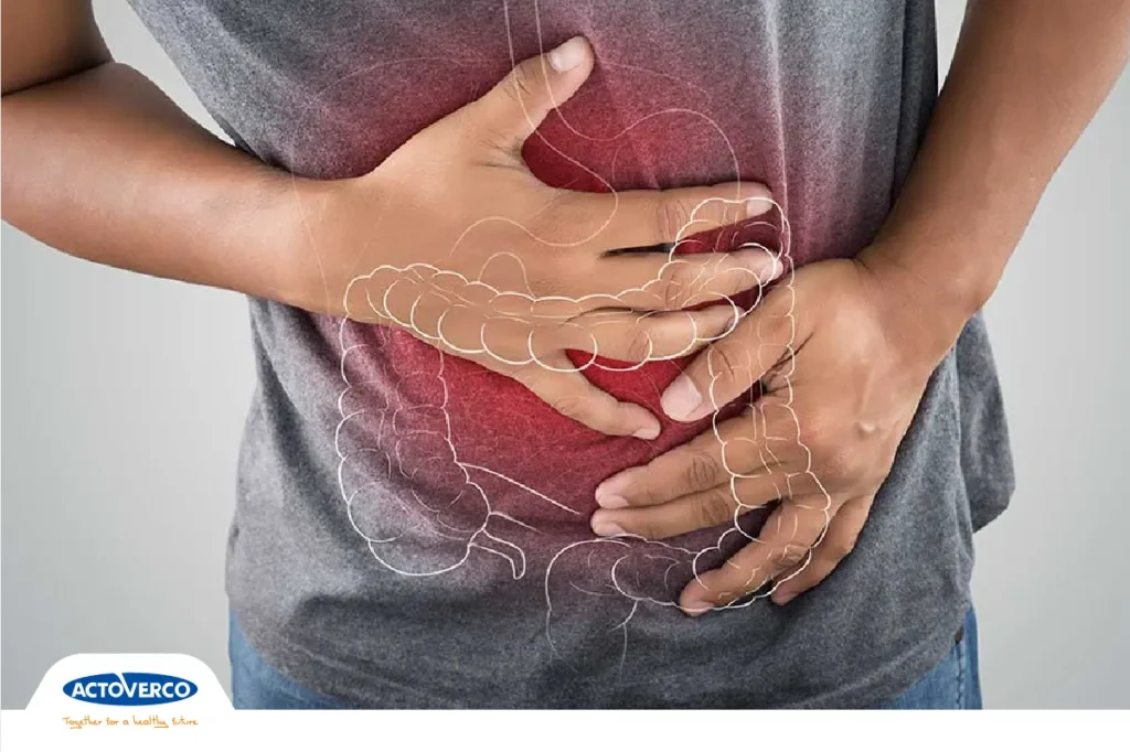 روده تحریک پذیر