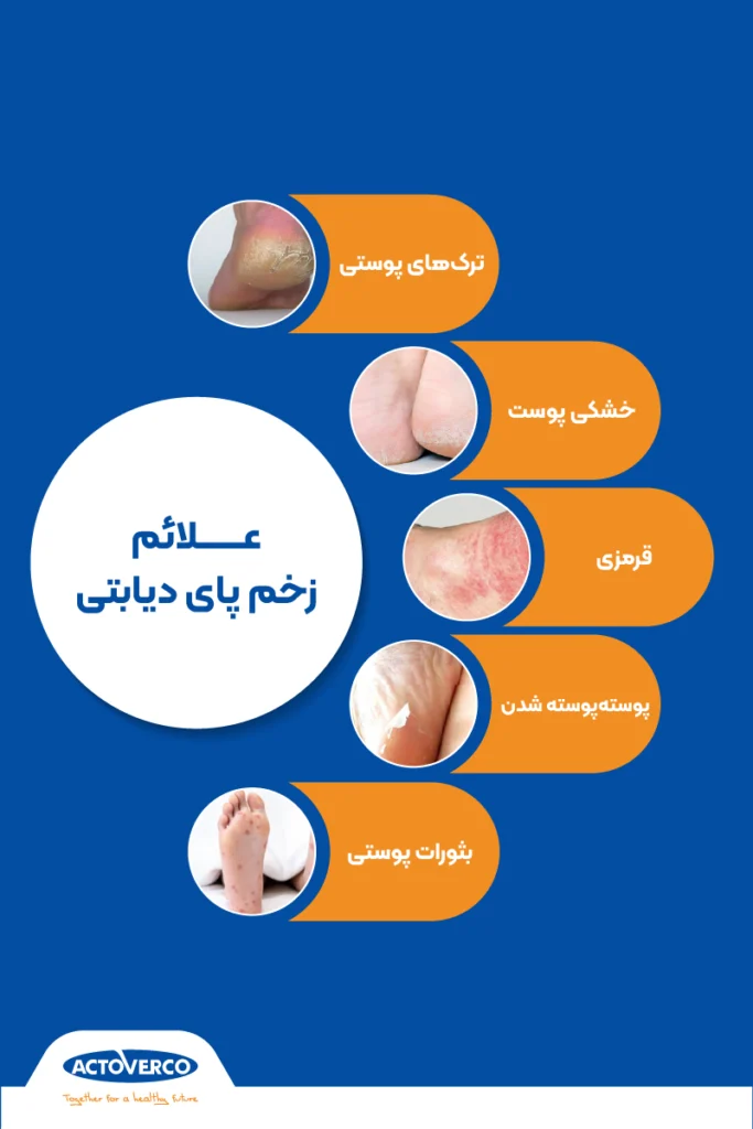 زخم پای دیابتی
