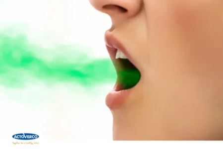 بوی بد دهان