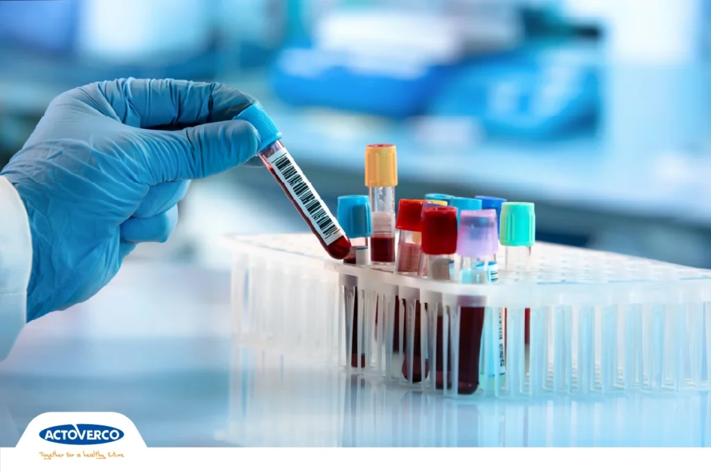 آزمایش-هموگلوبین-A1c