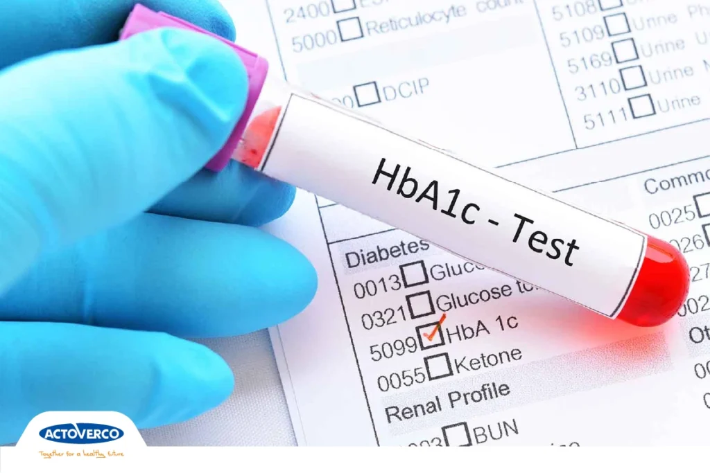 آزمایش-هموگلوبین-A1c