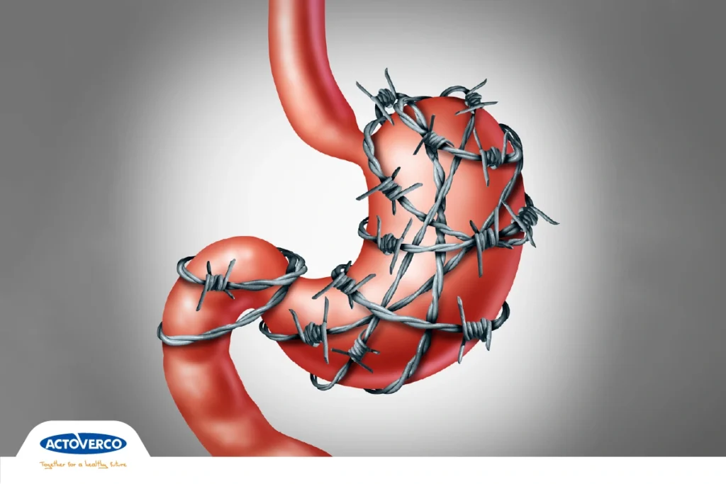 گاستروپارزی