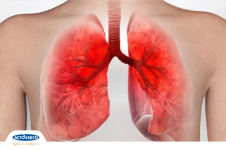 برونشیت چیست