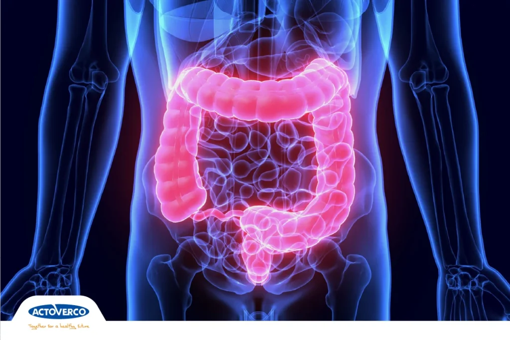 خونریزی مقعدی