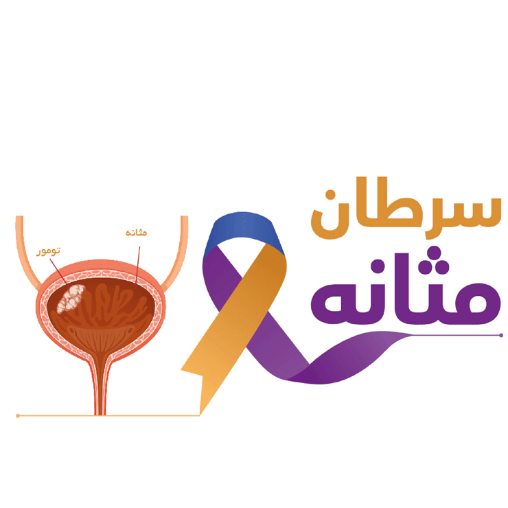 Bladder-cancer