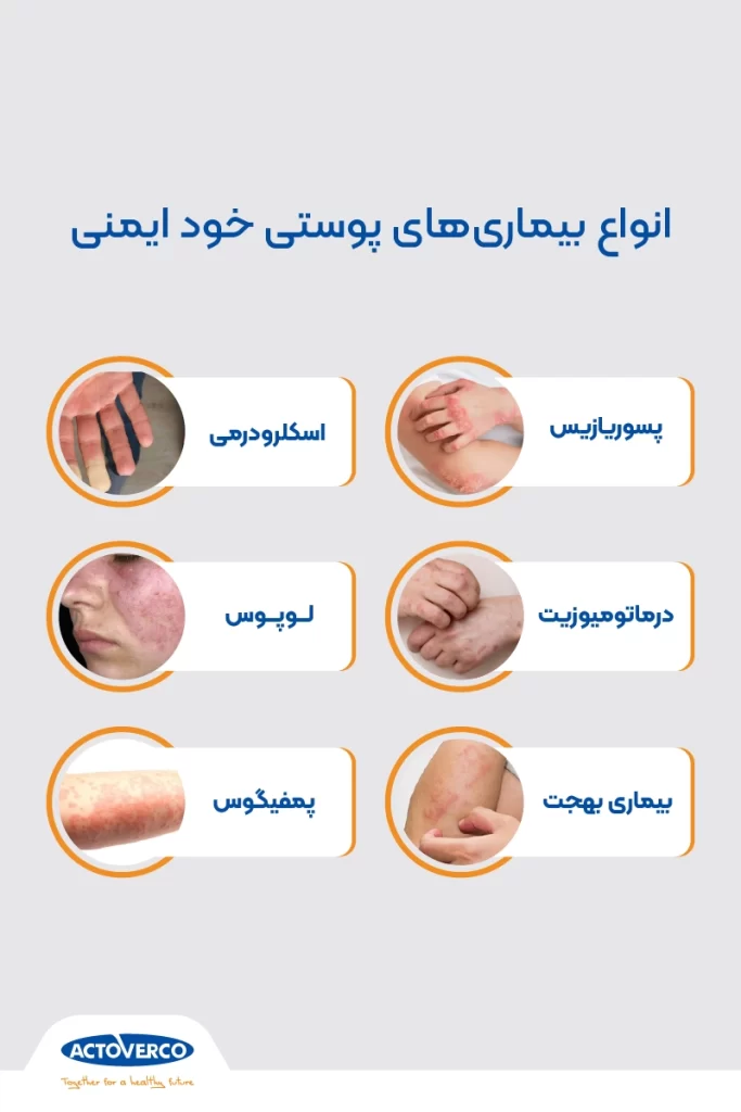 بیماری پوستی خود ایمنی