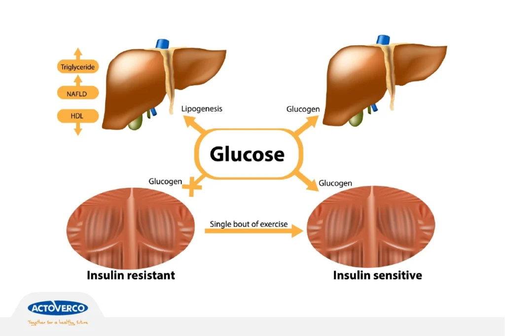 مقاومت به انسولین