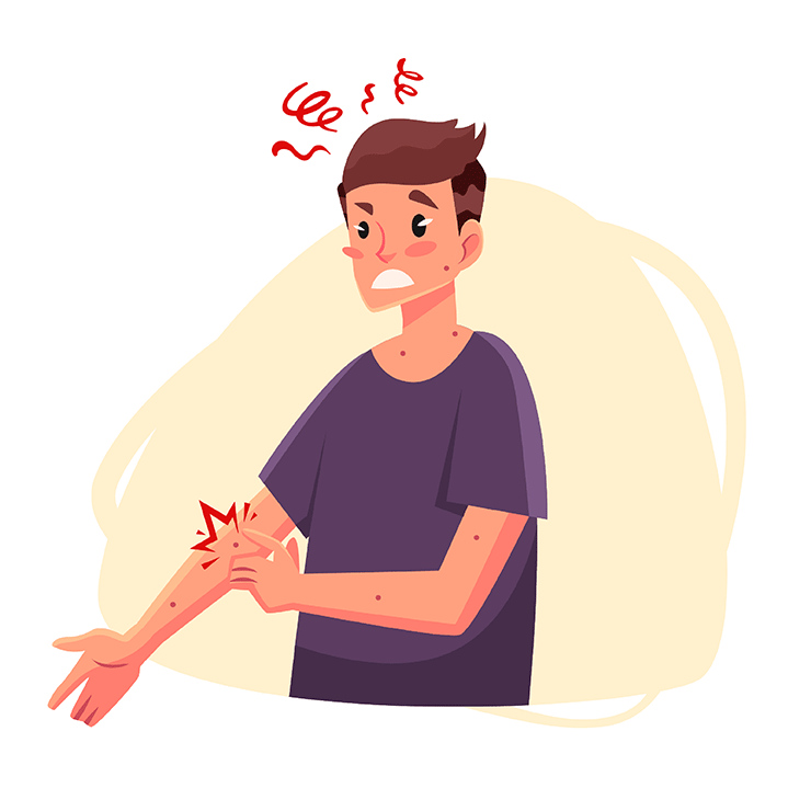 Psoriasis