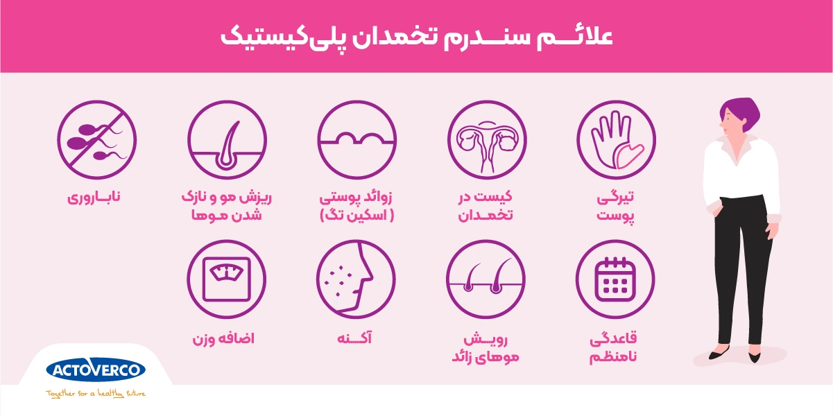 علائم تنبلی تخمدان
