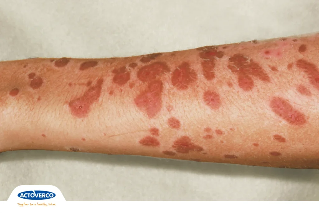 استیون جانسون