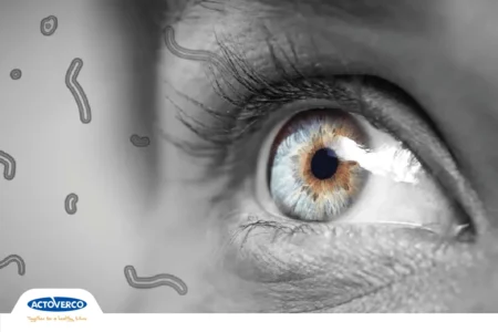 مگس پران چشم