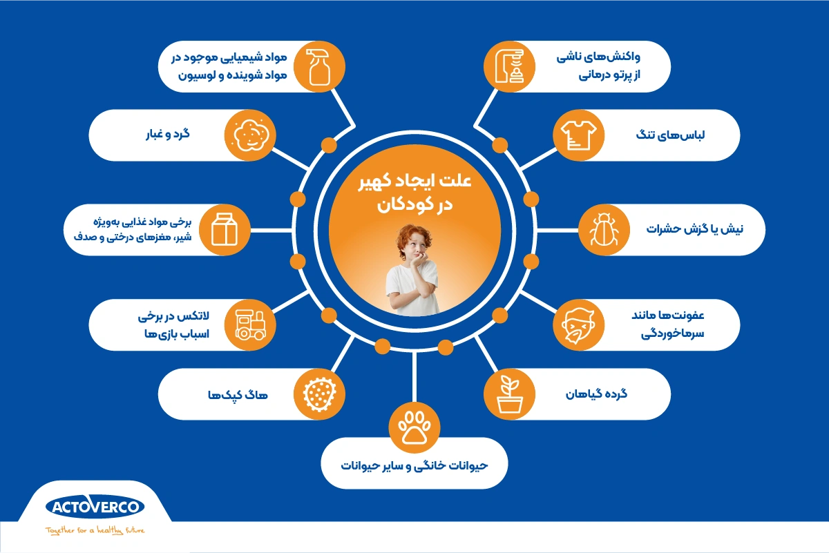 علت کهیر در کودکان