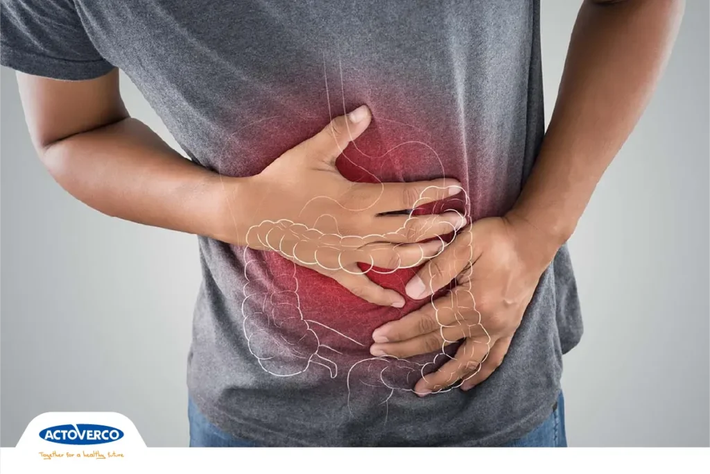 پنتوپرازول