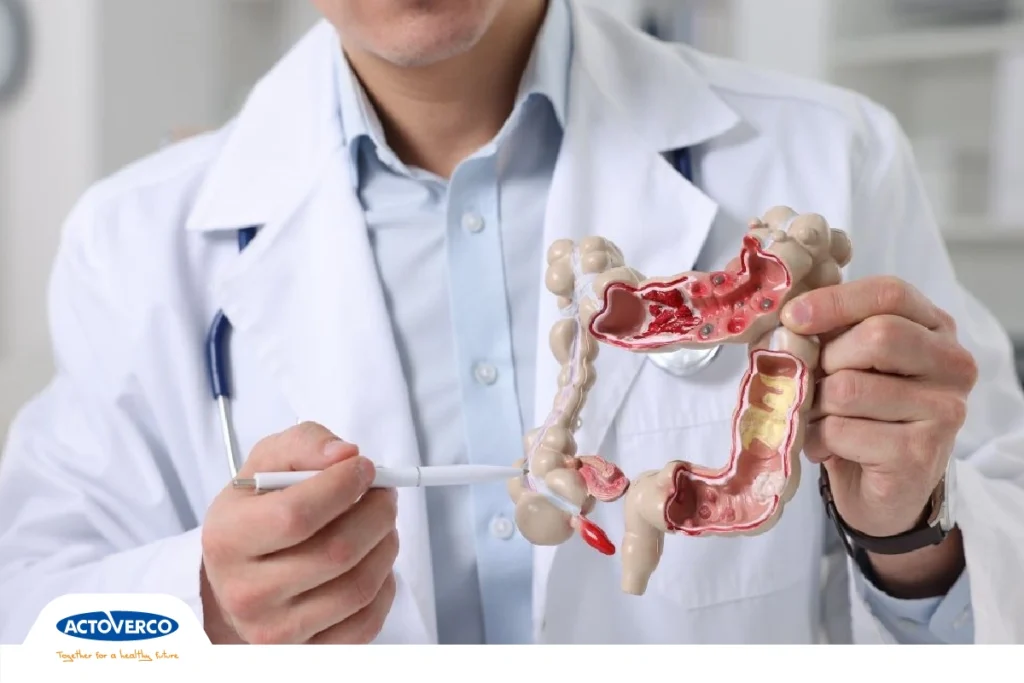 پنتوپرازول