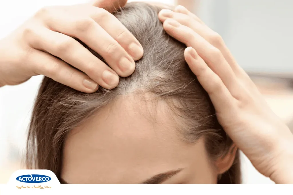 یائسگی و ریزش مو