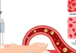 آهن تزریقی