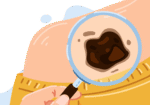 Skin cancer